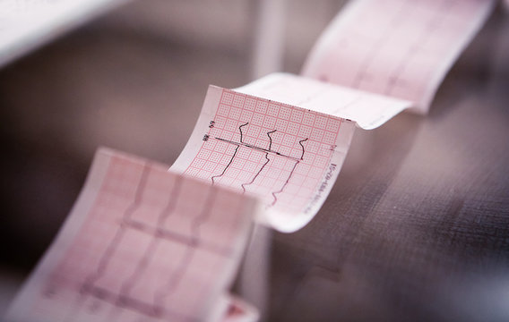 Medical cardiogram printed on paper on the table