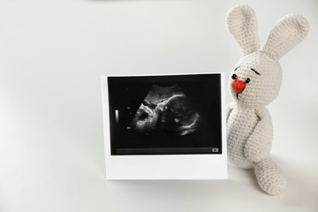Ultrasound photo of baby and toy on white background