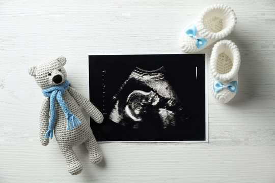Ultrasound photo of baby, toy and knitted boots on wooden background, flat lay