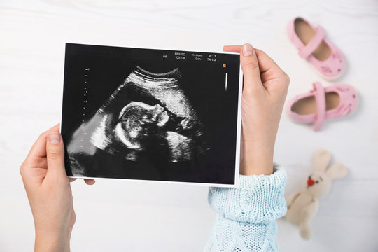Woman holding ultrasound photo of baby over table, top view