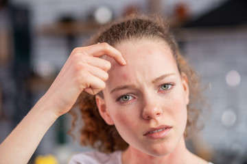 Distressed long-haired woman pointing on allergic spot
