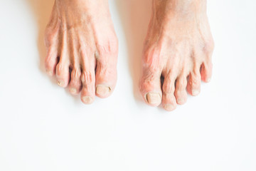 Both feet of the elderly on a white background