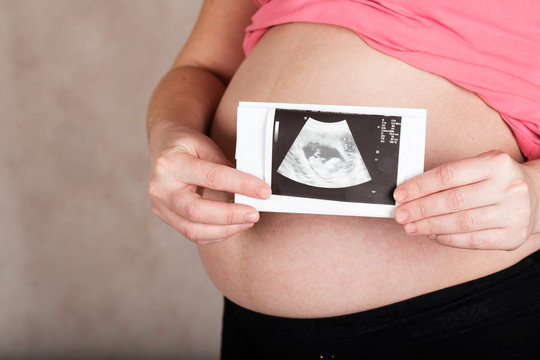 Young pregnant woman keeps USG image of her baby.
