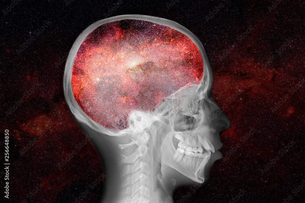 Canvas Prints x-ray of skull with universe inside