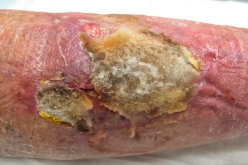 Ointment covered leg would on senior man in Tropical North Queensland, Australia