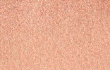 Cosmetology textured background from pink healthy human skin of the croup fired up, covered with...