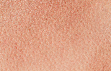 Cosmetology textured background from pink healthy human skin close-up anomie, covered with pores...