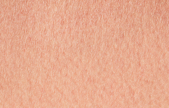 Cosmetology textured background from pink healthy human skin of the croup fired up, covered with pores and fine wrinkles