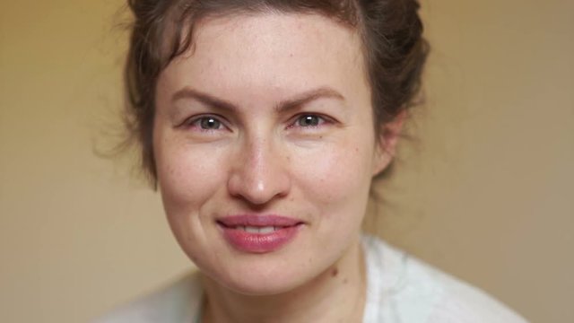 Portrait of a young woman with a medical diagnosis of squint. Ophthalmology concept