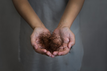 A woman suffering from hair loss. Balding.