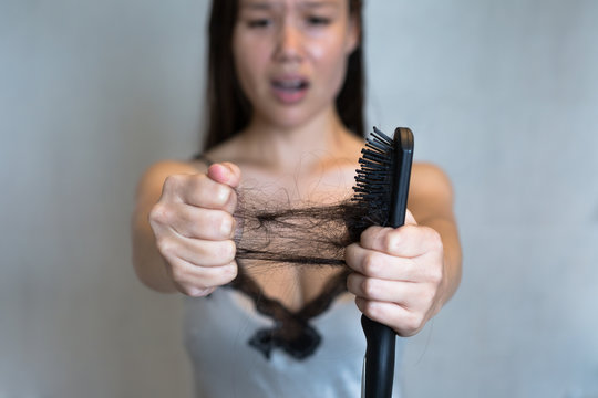 A Woman's Hair Falling Out. Hair Loss.