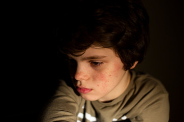 Portrait in the dark of a young caucasian teenager boy with allergic acne looking aside, pensive...