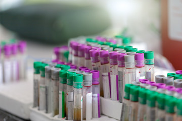 Colorful blood tubes in tray,Colorful blood tube test for analysis in the laboratory of haematology,spot focus.