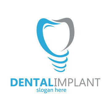 dental braces logo, dental implant, dental logo design