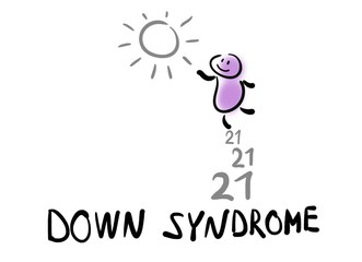 Trisomy 21 or down syndrome