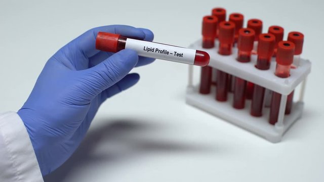 Lipid profile, doctor showing blood sample in tube, lab research, health checkup