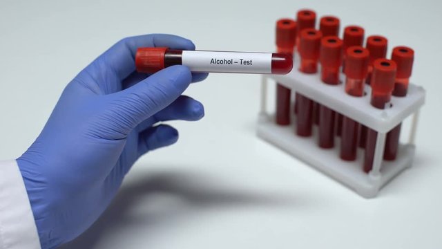 Alcohol test, doctor showing blood sample in tube, lab research, health checkup