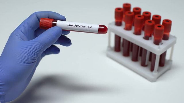 Liver function, doctor shows blood sample in tube, lab research, health checkup
