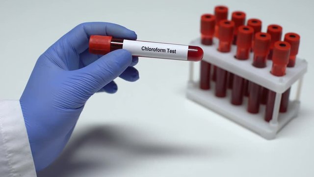 Chloroform test, doctor shows blood sample in tube, lab research, health checkup