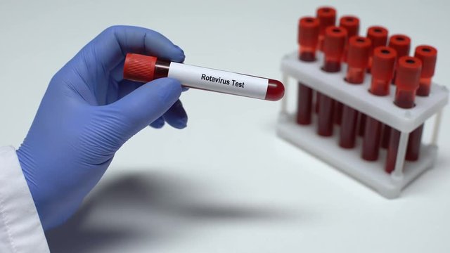 Rotavirus test, doctor shows blood sample in tube, lab research, health checkup