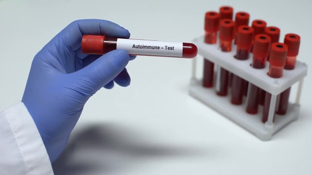 Autoimmune, doctor showing blood sample in tube, lab research, health checkup