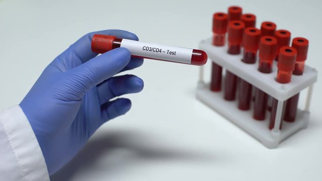 CD3 CD4 test, doctor showing blood sample in tube, lab research, health checkup