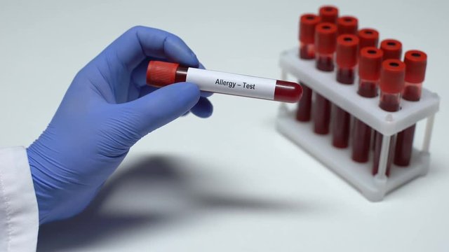 Allergy test, doctor showing blood sample in tube, lab research, health checkup