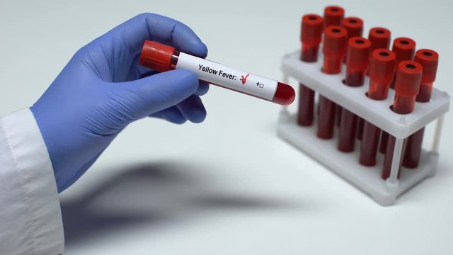 Negative Yellow fever test, doctor showing blood sample in tube, health checkup