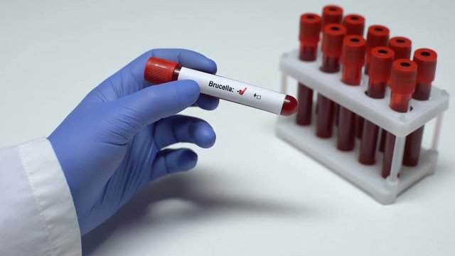 Negative Brucella test, doctor showing blood sample in tube, health checkup
