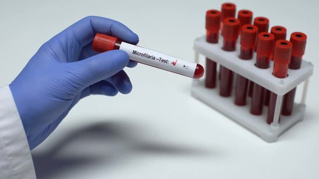 Negative Microfilaria test, doctor showing blood sample in tube, health checkup