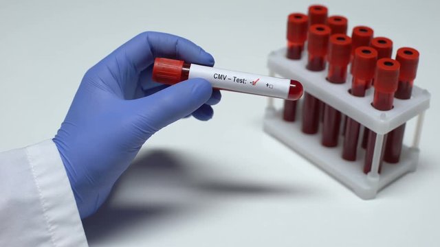 Negative CMV test, doctor showing blood sample, lab research, health checkup