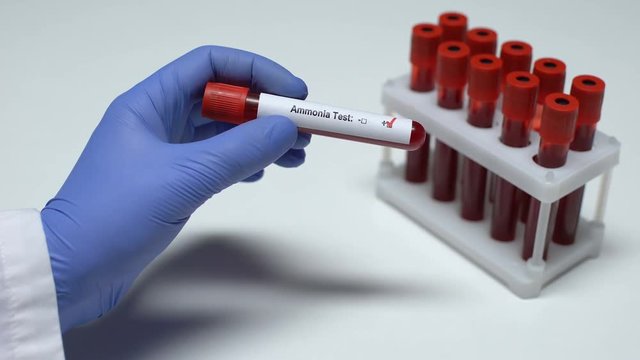Positive Ammonia test, doctor showing blood sample in tube, lab research, health