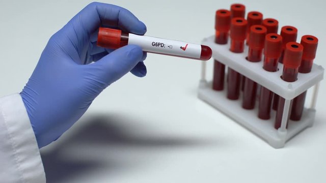 Positive G6PD test, doctor showing blood sample, lab research, health checkup