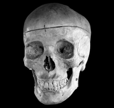 Human skull anatomy on black color background