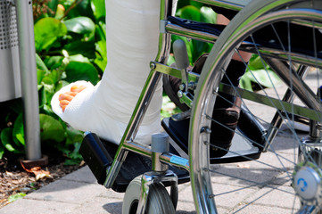 Gipsbein © Petra Beerhalter