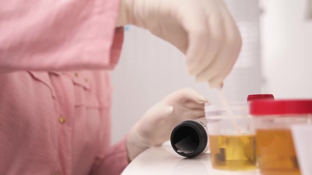 A close-up of a medical laboratory scientist immersing the test strip into a sample of urine