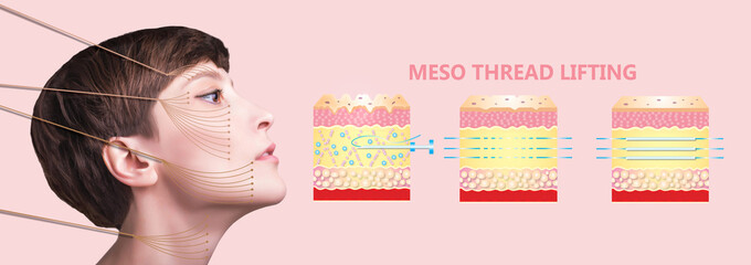Meso thread Lift. Young female with clean fresh skin. Beautiful woman. face and neck.