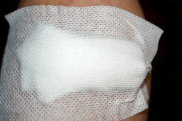 Vein on the hand sealed with a surgical plaster.