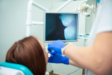 Beautiful girl with red hair is sitting in the dental chair. Treatment and prevention of dental diseases. Teeth whitening