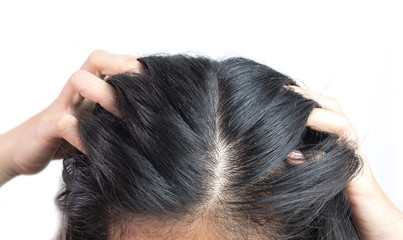 women head with dandruff Caused by the problem of dirty. Or caused by skin disease or Seborrheic Dermatitis. It has white scaly and it will cause itch. - obrazy, fototapety, plakaty