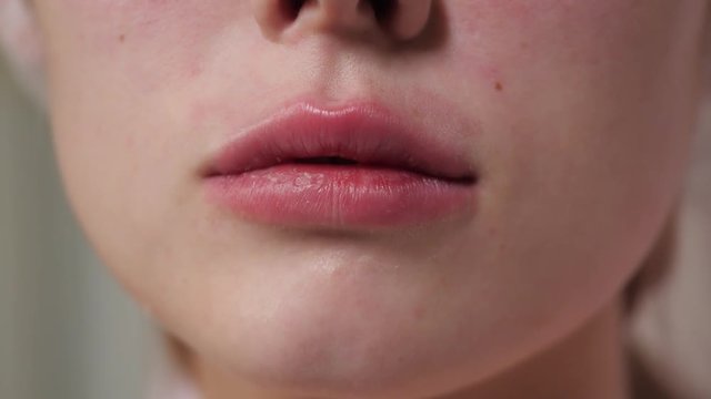 lips after injections
