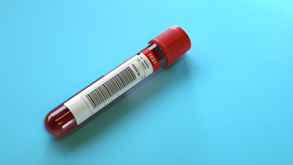 Blood test tubes  in the lab,Blood samples,3d rendering,conceptual image.