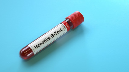Blood sample for hepatitis-B virus test,3d rendering,conceptual image.