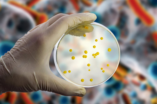 Colonies of microbes on Petri dish on the bacterial background, photo and 3D illustration