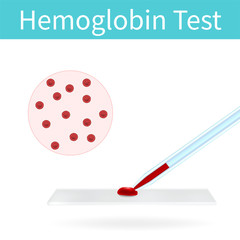 Blood test. Hemoglobin. Erythrocytes. Vector medical illustration. Pink abstract background.