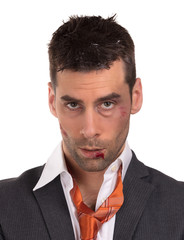 Close up of a businessman with bloody lip, beaten and bruised
