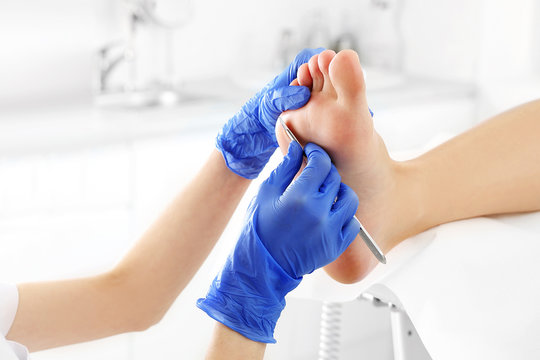 Podiatry. Removing calluses with a scalpel at the beautician.