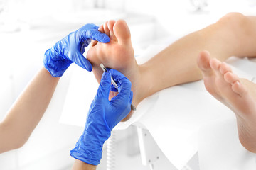 Podiatry. Removing calluses with a scalpel at the beautician. - obrazy, fototapety, plakaty