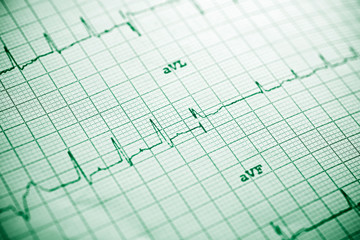 Electrocardiogram close up