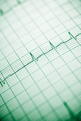 Electrocardiogram close up